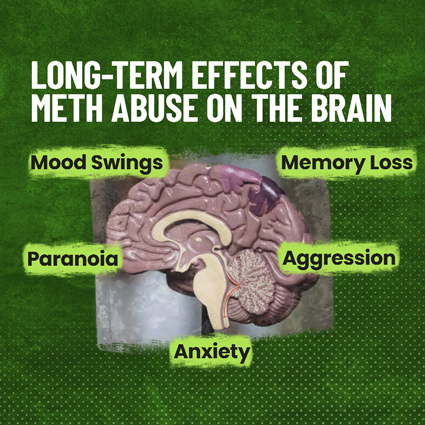 Infographic that says "long-term effects of meth abuse on the brain: mood swings, memory loss, paranoia, aggression, and anxiety."